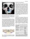 Perspectives on Zygomatic Implants, An Issue of Atlas of the Oral & Maxillofacial Surgery Clinics: Volume 29-2