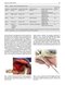 Perspectives on Zygomatic Implants, An Issue of Atlas of the Oral & Maxillofacial Surgery Clinics: Volume 29-2