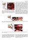 Perspectives on Zygomatic Implants, An Issue of Atlas of the Oral & Maxillofacial Surgery Clinics: Volume 29-2