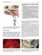 Perspectives on Zygomatic Implants, An Issue of Atlas of the Oral & Maxillofacial Surgery Clinics: Volume 29-2