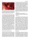 Perspectives on Zygomatic Implants, An Issue of Atlas of the Oral & Maxillofacial Surgery Clinics: Volume 29-2