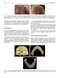 Perspectives on Zygomatic Implants, An Issue of Atlas of the Oral & Maxillofacial Surgery Clinics: Volume 29-2