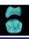 Dental Anatomy and Morphology