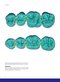 Dental Anatomy and Morphology
