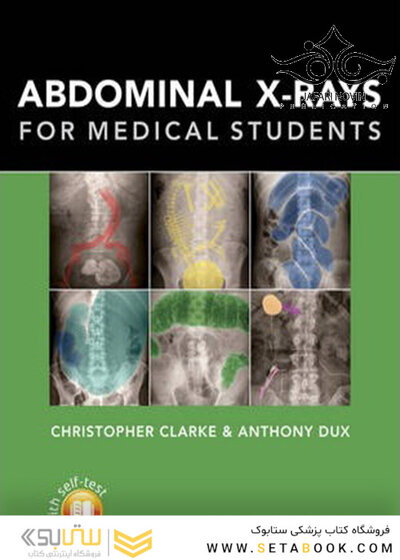 Abdominal X-rays for Medical Student2015