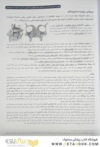 از نگاهی دیگر تصویر برداری سر و گردن som