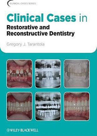 Clinical Cases in Restorative and Reconstructive Dentistry2010 موارد بالینی در دندانپزشکی ترمیمی