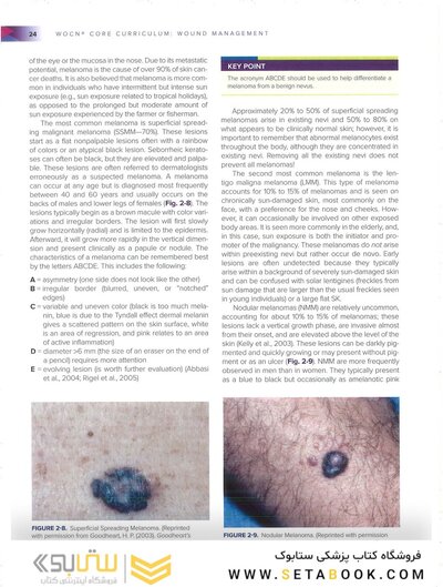 Wound, Ostomy, and Continence Nurses Society Core Curriculum: Wound Management Second, North American Edición