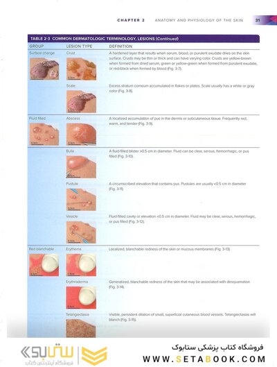 Wound, Ostomy, and Continence Nurses Society Core Curriculum: Wound Management Second, North American Edición
