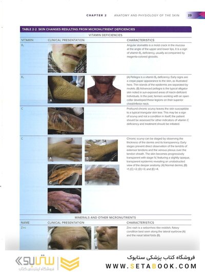 Wound, Ostomy, and Continence Nurses Society Core Curriculum: Wound Management Second, North American Edición