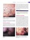 Wound, Ostomy, and Continence Nurses Society Core Curriculum: Wound Management Second, North American Edición