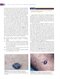 Wound, Ostomy, and Continence Nurses Society Core Curriculum: Wound Management Second, North American Edición
