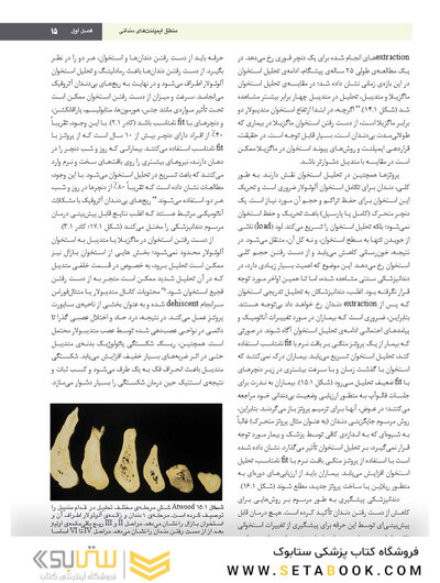 ایمپلنت دندانی میش 2021 جلد اول