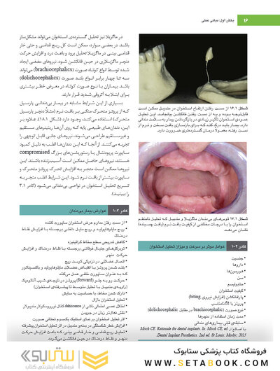 ایمپلنت دندانی میش 2021 جلد اول