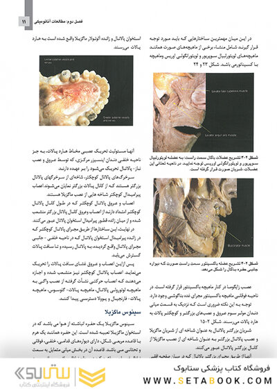 مبانی جراحی ایمپلنت های زایگوما (اصول دسترسی آناتومی)