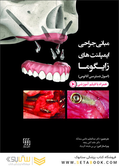 مبانی جراحی ایمپلنت های زایگوما (اصول دسترسی آناتومی)
