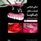 مبانی جراحی ایمپلنت های زایگوما (اصول دسترسی آناتومی)