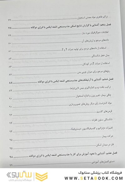 سنجش تراکم استخوان
