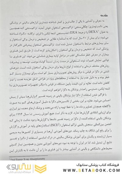 سنجش تراکم استخوان