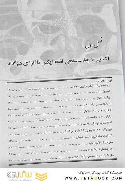 سنجش تراکم استخوان