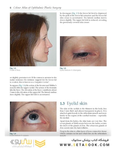 Colour Atlas of Ophthalmic Plastic Surgery 4th Edition2017