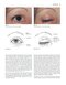 Colour Atlas of Ophthalmic Plastic Surgery 4th Edition2017