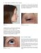 Colour Atlas of Ophthalmic Plastic Surgery 4th Edition2017