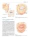 Colour Atlas of Ophthalmic Plastic Surgery 4th Edition2017