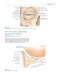 Colour Atlas of Ophthalmic Plastic Surgery 4th Edition2017