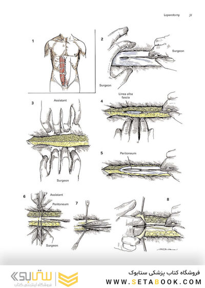 Zollinger's Atlas of Surgical Operations, Eleventh Edition 11th Edition
