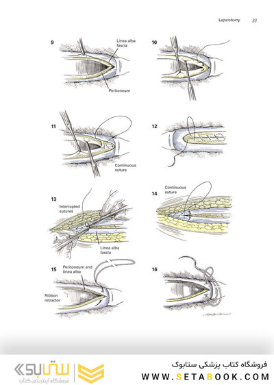 Zollinger's Atlas of Surgical Operations, Eleventh Edition 11th Edition