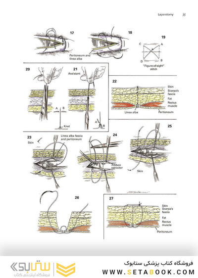 Zollinger's Atlas of Surgical Operations, Eleventh Edition 11th Edition