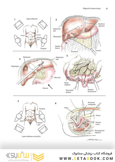 Zollinger's Atlas of Surgical Operations, Eleventh Edition 11th Edition