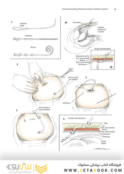 Zollinger's Atlas of Surgical Operations, Eleventh Edition 11th Edition