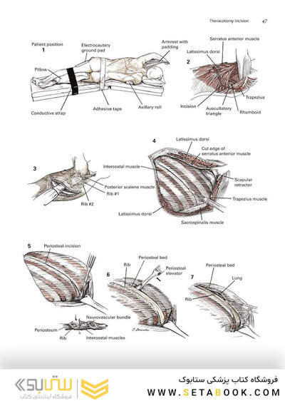 Zollinger's Atlas of Surgical Operations, Eleventh Edition 11th Edition