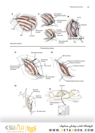Zollinger's Atlas of Surgical Operations, Eleventh Edition 11th Edition