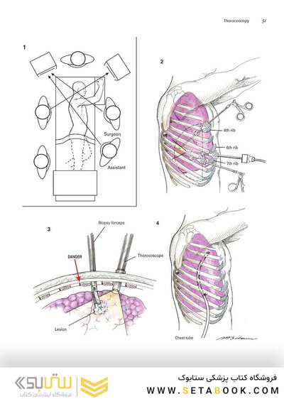 Zollinger's Atlas of Surgical Operations, Eleventh Edition 11th Edition