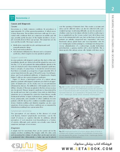 The Digestive System: Systems of the Body Series 2nd Edition