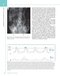 The Digestive System: Systems of the Body Series 2nd Edition