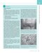 The Digestive System: Systems of the Body Series 2nd Edition