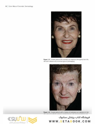 Color Atlas of Cosmetic Dermatology, 2nd Edition 2011