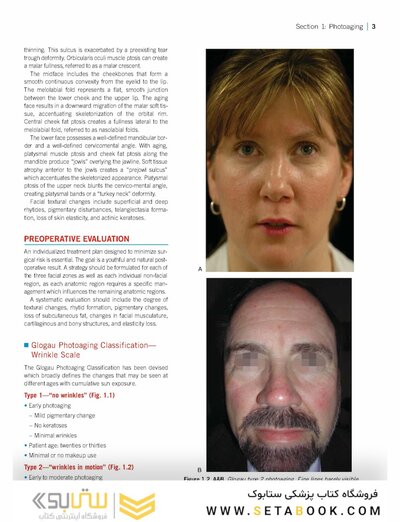 Color Atlas of Cosmetic Dermatology, 2nd Edition 2011