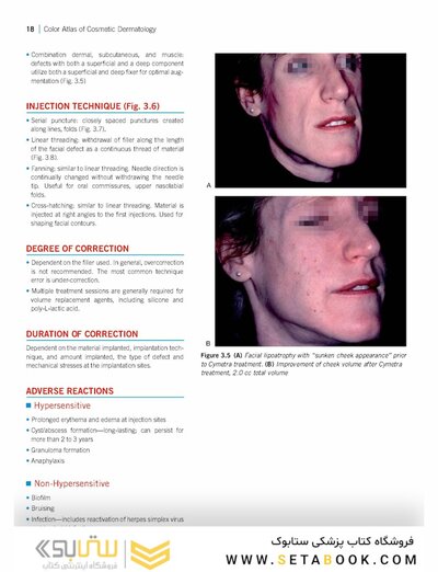 Color Atlas of Cosmetic Dermatology, 2nd Edition 2011