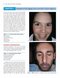 Color Atlas of Cosmetic Dermatology, 2nd Edition 2011