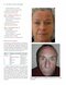 Color Atlas of Cosmetic Dermatology, 2nd Edition 2011