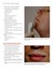 Color Atlas of Cosmetic Dermatology, 2nd Edition 2011