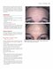 Color Atlas of Cosmetic Dermatology, 2nd Edition 2011