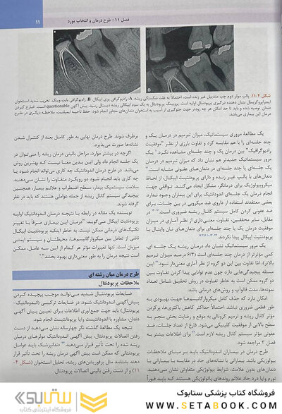 اندودانتیکس اینگل 2019 جلد 2