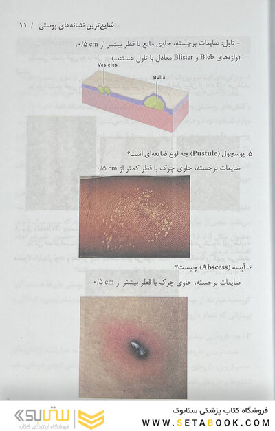دارودرمانی بیماری  های پوست