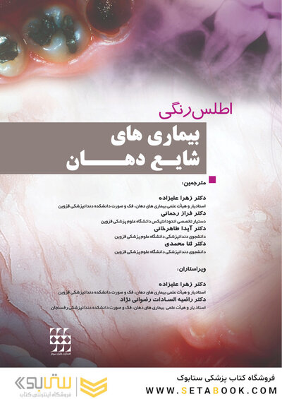 اطلس رنگی بیماری های شایع دهان